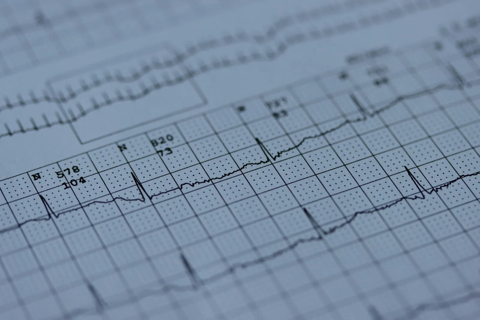 Close-up of a paper chart recording with a spiking line trace
